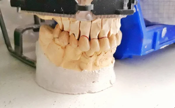 Technika Dentystyczna Produkcja Zębów Warsztaty Złe Zęby — Zdjęcie stockowe