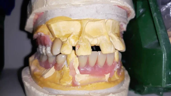 歯科技工士歯の生産 ワークショップ 悪い歯 — ストック写真