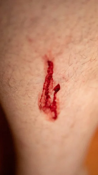 Una Pequeña Herida Pierna Con Sangre Que Fluye — Foto de Stock