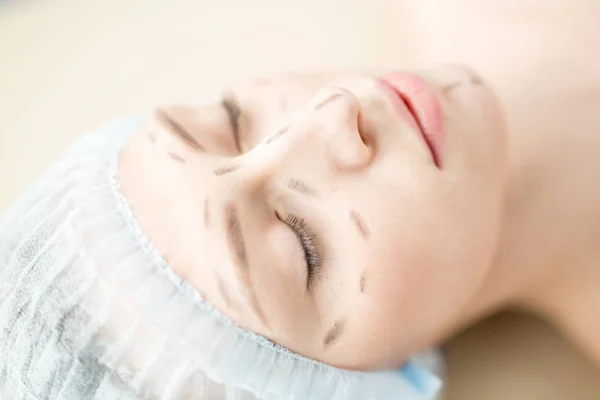 Gesicht Einer Jungen Frau Mit Flecken Die Augen Auf Der — Stockfoto