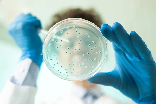 아래는 생물학자가 실험실에서 연구를 하면서 페트리 접시에서 파란색 물질의 샘플을 — 스톡 사진