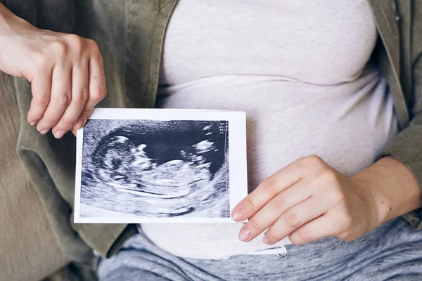 Mãos Mulher Grávida Casualwear Segurando Foto Seu Futuro Bebê Sobre — Fotografia de Stock