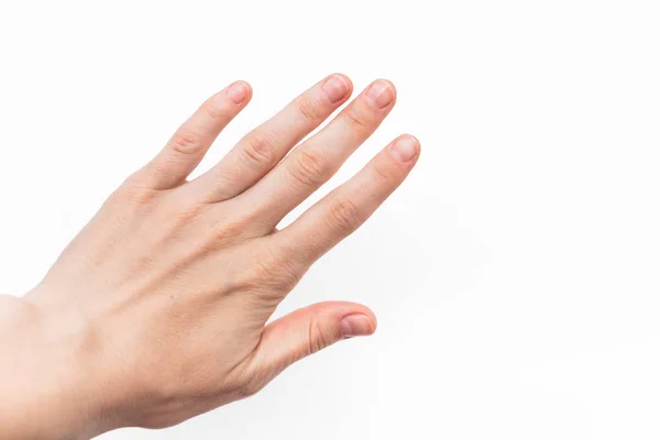 Női kéz rövid körmökkel és ügyes manikűrrel, lakk nélkül, fehér alapon, az ízületek artrózis, normál bőrre — Stock Fotó