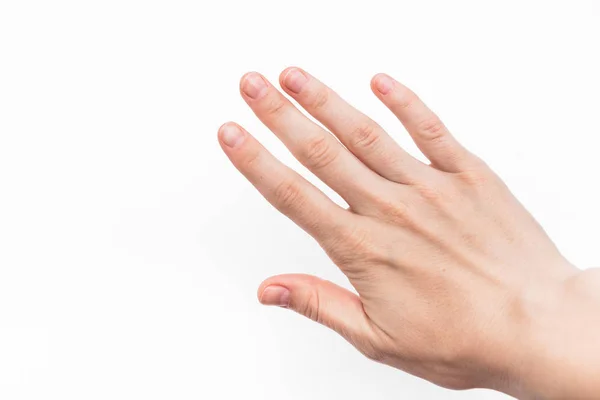 白い背景にニスなしの短い爪ときちんとしたマニキュアを持つ女性の手、関節の関節症、正常な皮膚 — ストック写真