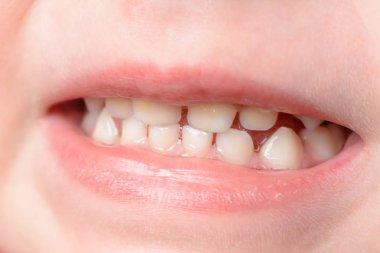 O güldüğünde küçük bebeğin diş de makro çekim