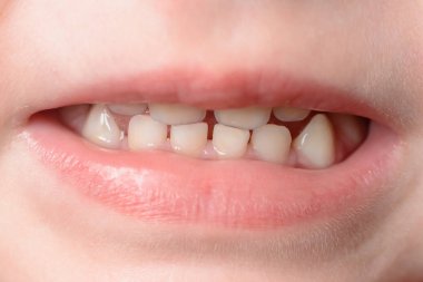 O güldüğünde küçük bebeğin diş de makro çekim