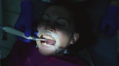 Dişçinin muayenehanesindeki kadın, tartardan dişlerini fırçalarken, dişçi ultrason kullanıyor..