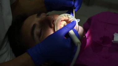 Ağız temizliği, dişçi muayenehanesinde bir adam dişlerdeki tartar ve plağı çıkarmak, ultrason kullanmak..