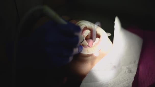 Dentista Conduce Igiene Orale Paziente Con Ultrasuoni — Video Stock