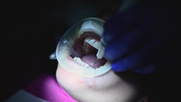 Dentista Realiza Higiene Bucal Paciente Con Ultrasonido — Vídeo de stock