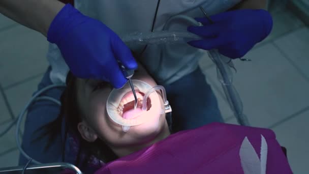 Pacjent Dentysty Usuwanie Tataru Pomocą Ultradźwięków — Wideo stockowe