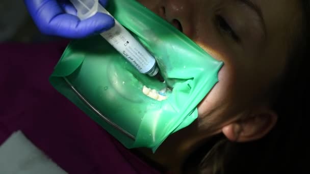 Der Patient Einem Stuhl Der Zahnarztpraxis Führt Zahnärztliche Eingriffe Durch — Stockvideo