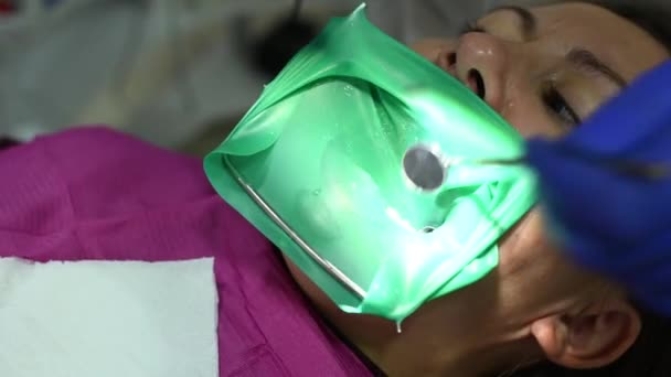Paciente Una Silla Consultorio Del Dentista Realiza Procedimientos Dentales Tratamiento — Vídeos de Stock