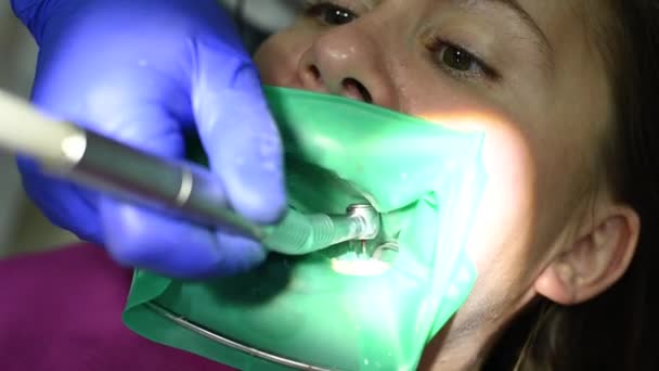 Пациент Стуле Кабинете Стоматолога Выполняет Стоматологические Процедуры Стоматологическое Лечение Сверление — стоковое видео