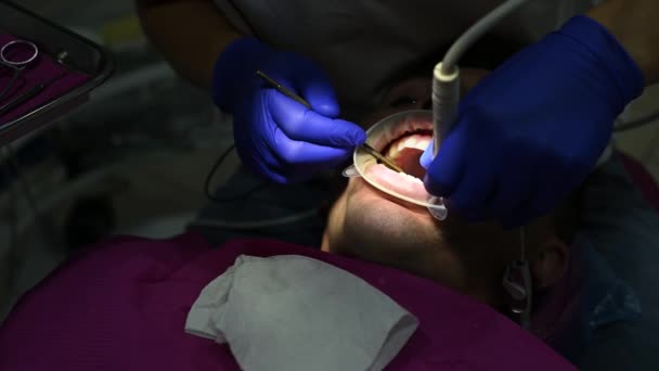 歯医者は超音波を使って歯車と硬い歯垢を取り除きます — ストック動画