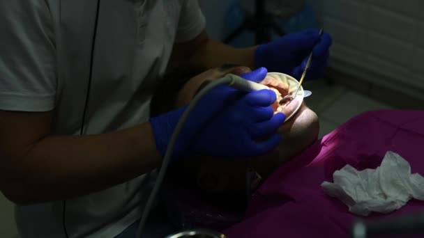 Higiene Bucal Hombre Consultorio Del Dentista Extracción Sarro Placa Los — Vídeo de stock