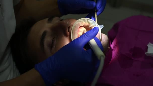 Στοματική Υγιεινή Ένας Άντρας Στο Οδοντιατρείο Αφαίρεση Ταρτάρ Και Πλάκας — Αρχείο Βίντεο