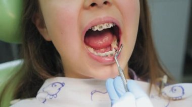 Bağlı parantez ile bir kızın dişlerin yakın çekim muayene