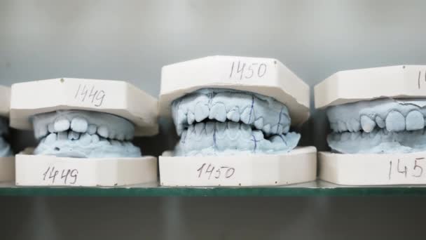 Dental gipsowe modele obsady ludzkiej szczęki stomatologiczne — Wideo stockowe