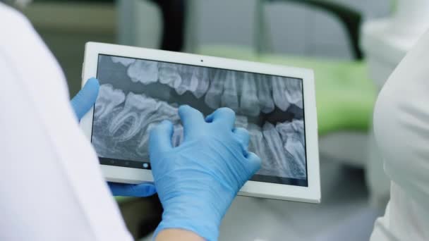 Дантист смотрит на рентген зубов человека на цифровом планшете . — стоковое видео