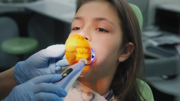 Orthodontist schijnt op de tanden met een lamp van fotopolymeer — Stockvideo