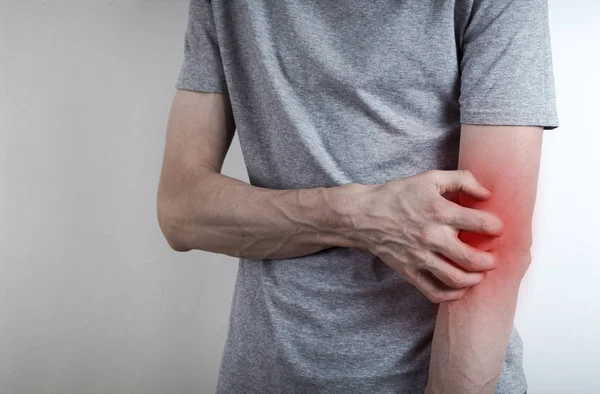 Joven Con Dolor Brazo — Foto de Stock