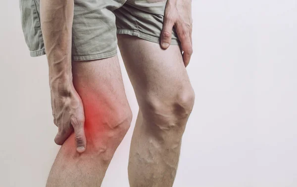Bir Adamın Bacağında Acı — Stok fotoğraf