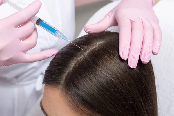 Mesoterapia Para Cabelo Injeção Linha Cabelo Cabeça Uma Mulher Procedimento — Fotografia de Stock