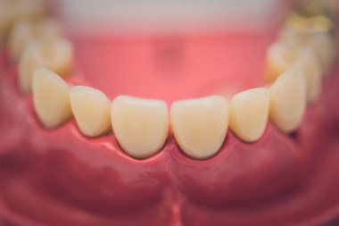 Kadar yakın diş takma diş ya da diş bir tabloda, diş hekimliği, ayrıntılı