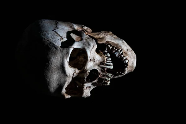 Ludzka Czaszka Szkielet Głowy Czarnym Tle — Zdjęcie stockowe