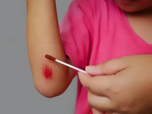 El bir yara kol yaralanma acı aşınma çizikler ile kaza düşme nedeniyle lezyonlar temizler. Seçici odak