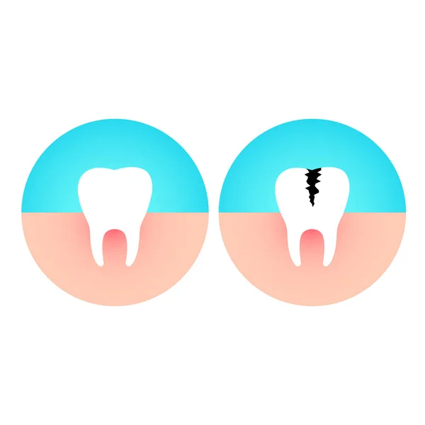 Zdrowe Zniszczonych Zębów Próchnica Choroby Płaskie Wektor Ilustracja — Wektor stockowy