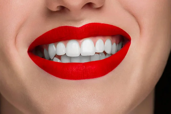 Sonrisa Femenina Feliz Cerca Con Dientes Blancos Sanos Maquillaje Labios —  Fotos de Stock