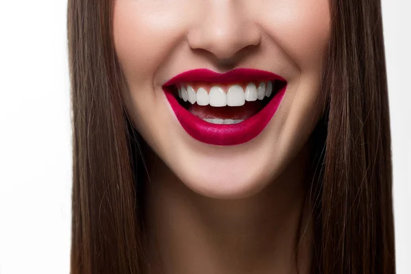 Perfecte Lach Het Bleken Tandheelkundige Verzorging Bleken Van Tanden Stomatologie — Stockfoto