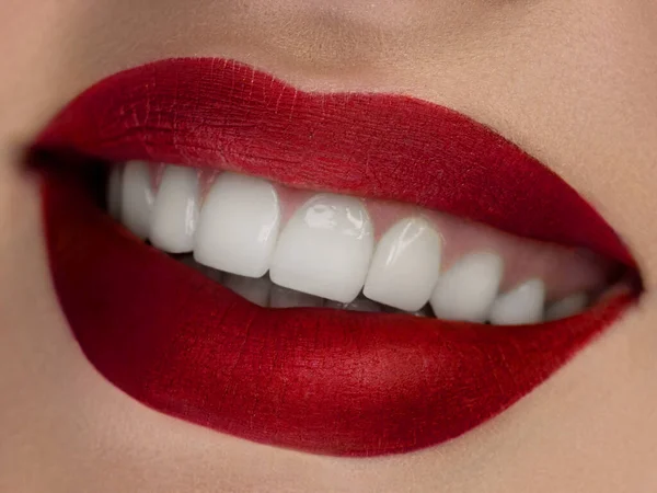 Sonrisa perfecta después del blanqueamiento. Cuidado dental y blanqueamiento de dientes. Estomatología y cuidado de belleza. Mujer sonriendo con grandes dientes. Sonrisa femenina alegre con piel fresca y clara — Foto de Stock