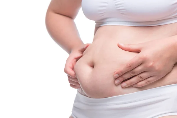 Überschüssiges Fett am Bauch Nahaufnahme Konzept Fettleibigkeit und wei — Stockfoto