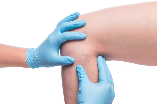 bacakta varis ile doktor ve hasta, yakın çekim medi