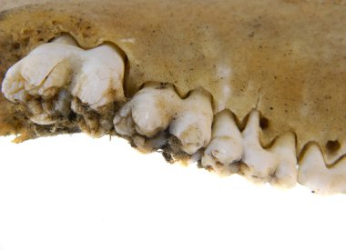 Beyaz Arkaplanda İzole Dişler