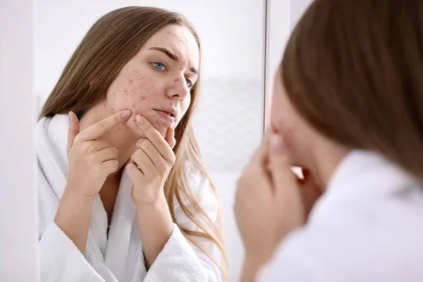 Young Woman Acne Problem Mirror Bathroom — Stock Photo, Image