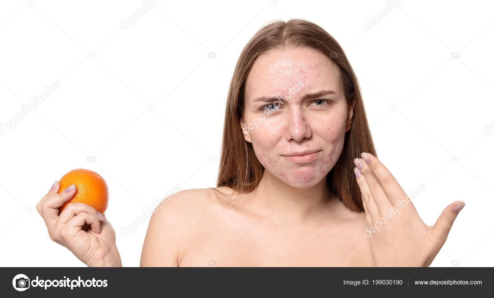 alergia a la piel de naranja alergia a la piel de naranja