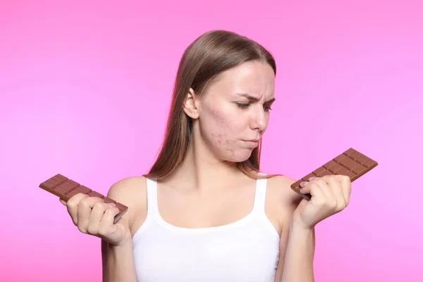 Mujer Joven Con Problemas Acné Sosteniendo Barras Chocolate Fondo Color — Foto de Stock
