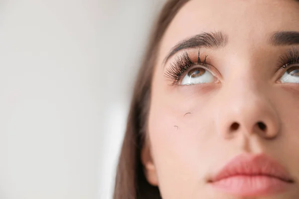 Mujer Joven Con Problemas Pérdida Pestañas Sobre Fondo Claro Primer — Foto de Stock