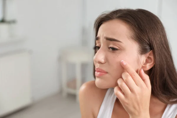 Young Woman Eyelash Loss Problem Indoors — Stock Photo, Image