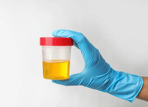 Travailleur Laboratoire Tenant Bocal Avec Échantillon Urine Sur Fond Clair — Photo