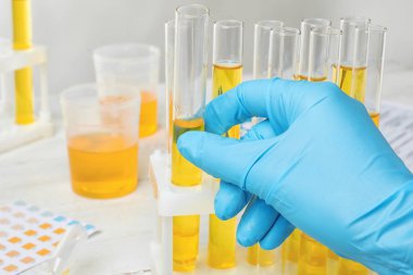 İdrar örneği sahibinden, closeup ile laboratuvar işçi alarak test tüp. Üroloji kavramı
