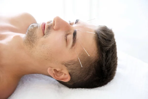 Young Man Undergoing Acupuncture Treatment Salon — Stock Photo, Image