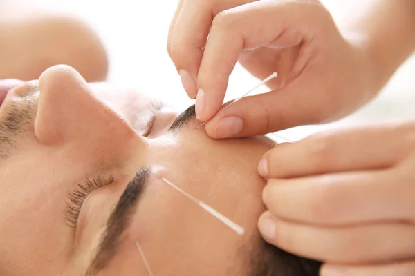 Salonda Closeup Akupunktur Tedavisi Gören Genç Adam — Stok fotoğraf