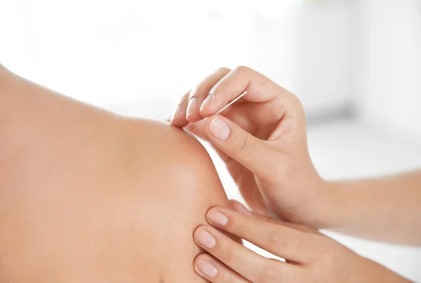 Young Woman Undergoing Acupuncture Treatment Salon Closeup — Stock Photo, Image