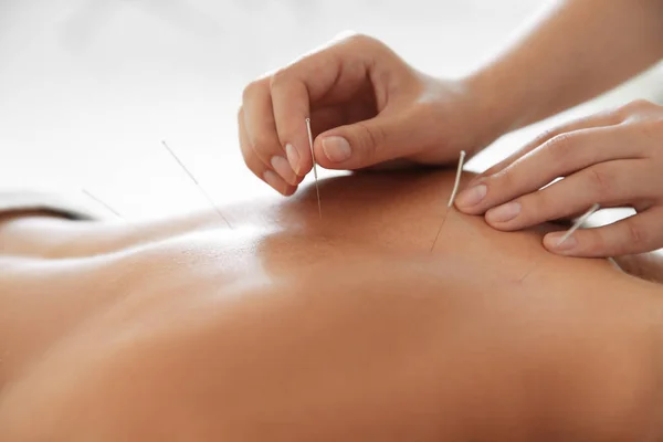 Junge Frau Unterzieht Sich Einer Akupunktur Behandlung Salon Nahaufnahme — Stockfoto