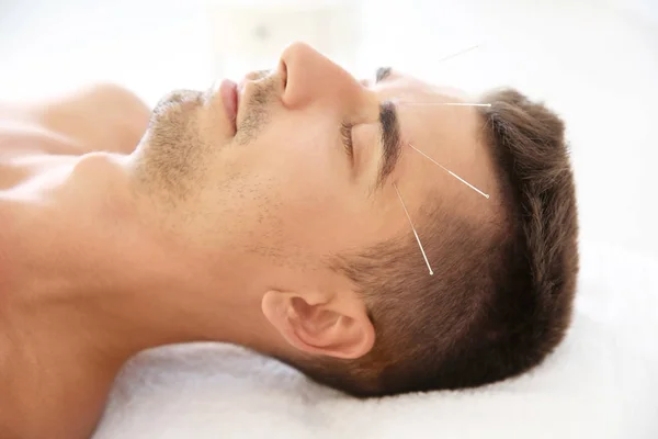 Young Man Undergoing Acupuncture Treatment Salon Closeup — Stock Photo, Image